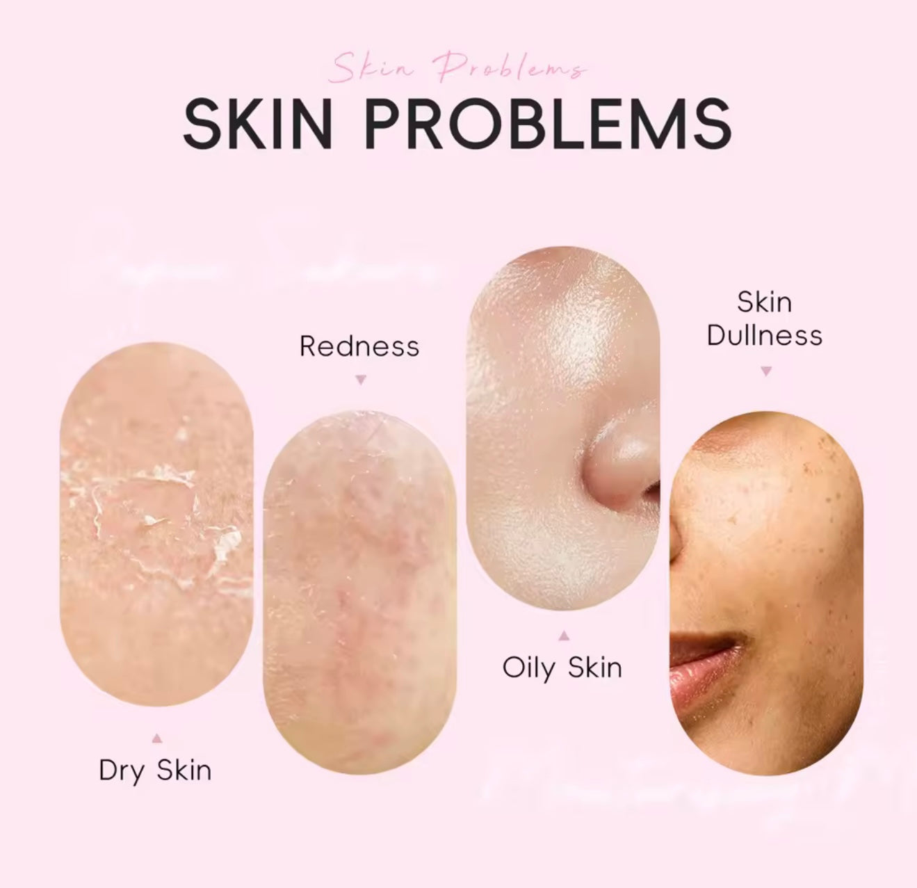 Masque Sakura – Nettoyant anti-imperfections et boutons